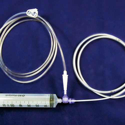 Intragastric Zayıflama Balonu
